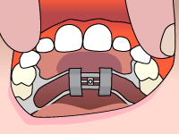 dentsit