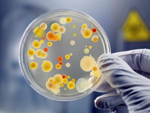 Important Things To Know About Plasmid Preparation
