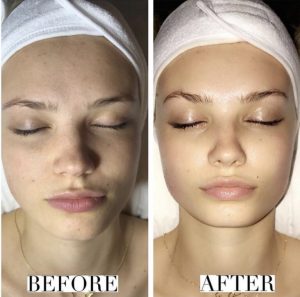 What Results Will You See!